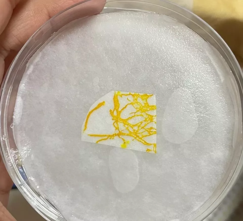 年轻人开始养黏菌当宠物,有人一株黏菌养7年多
