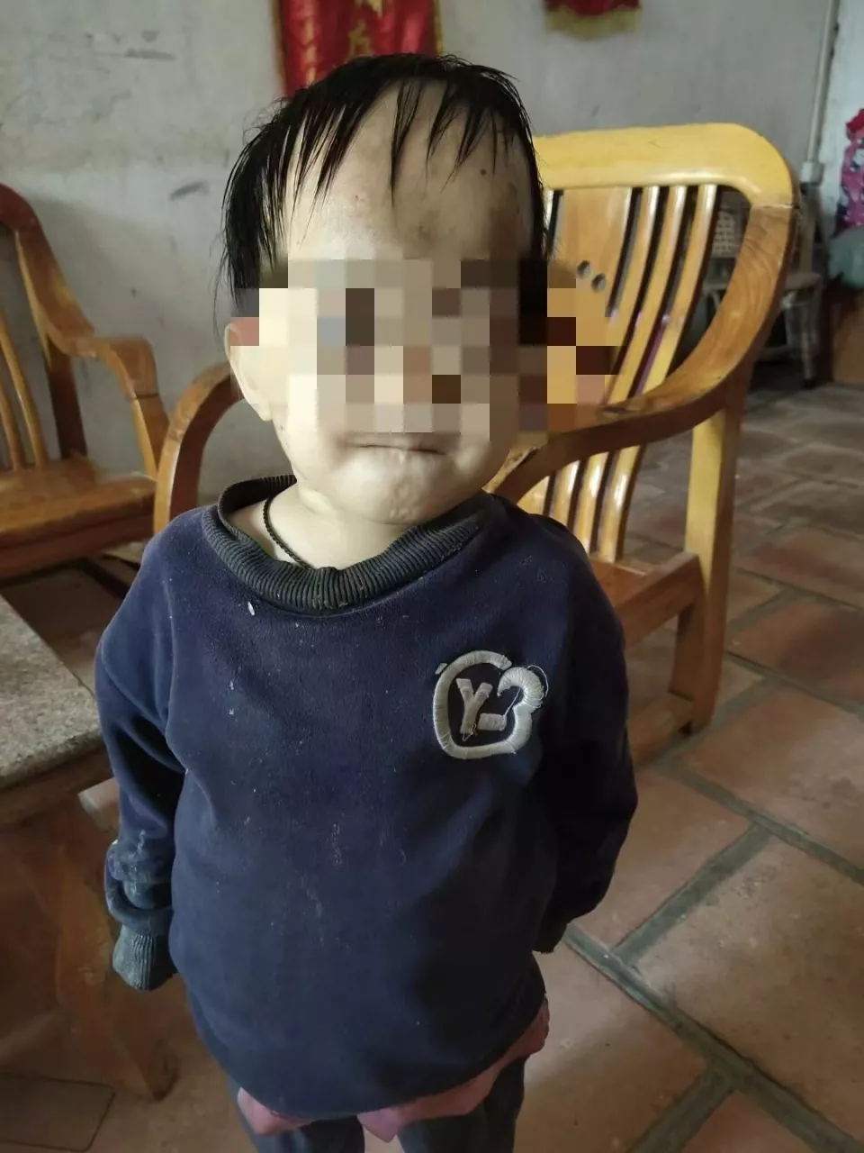 患病女童被遗弃在道观多年，其父亲称“送给佛祖”