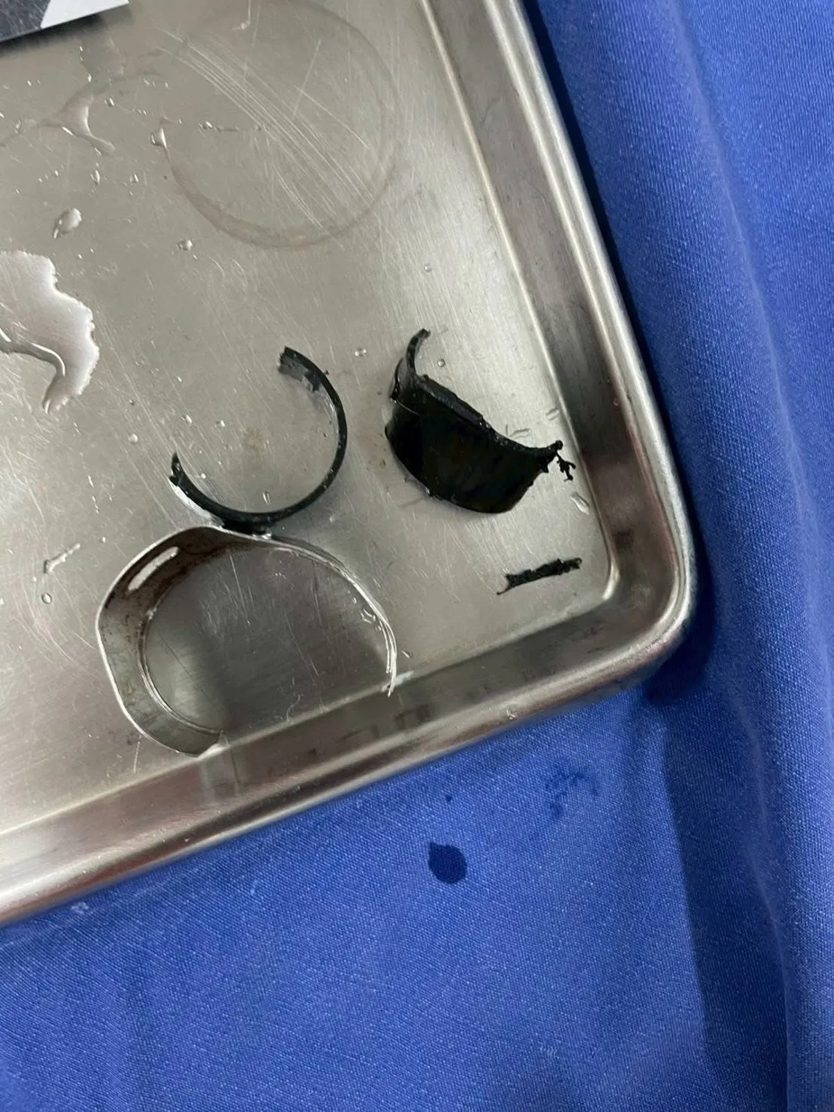 怕天赋异禀命根被偷 自锁双环 肿如拳头险坏死 怕天赋异禀命根被偷 自锁双环 肿如拳头险坏死