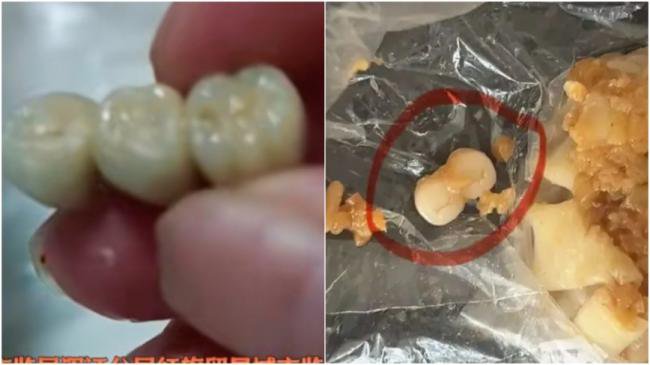 吓人!吉林香肠吃出3颗牙 广东烧麦吃出2颗 吓人!吉林香肠吃出3颗牙 广东烧麦吃出2颗