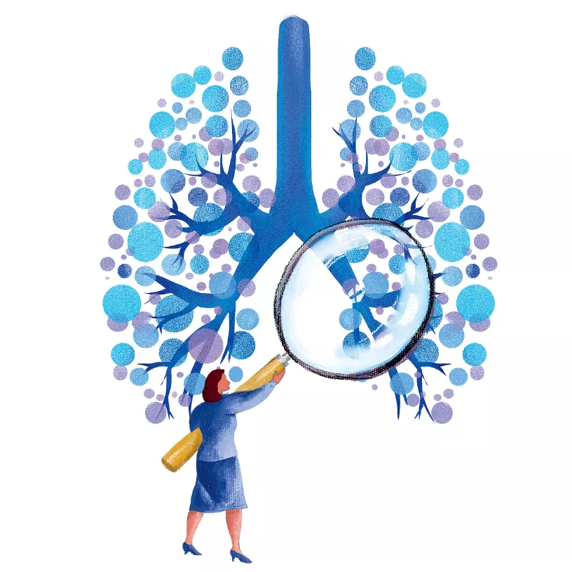 超过男性!为什么越来越多不抽烟的女性得肺癌?