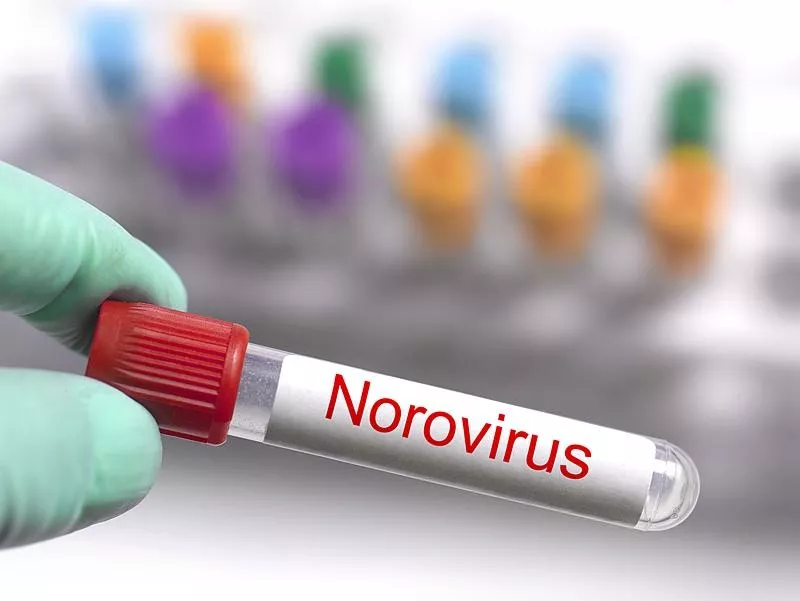 山东职校逾400人感染诺如病毒 同学排长龙如厕…