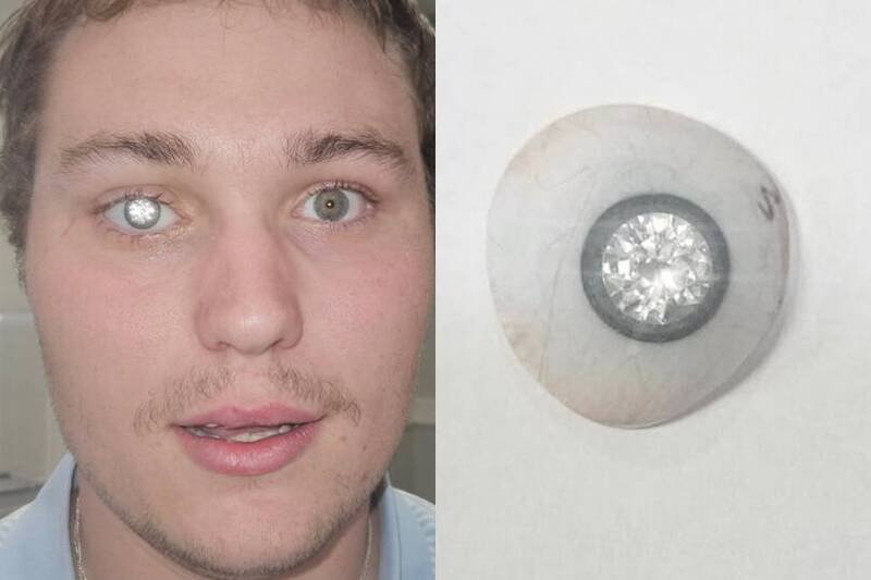 美国一名年轻珠宝设计师右眼失明后，斥资200万美元（约新台币6146万元）打造镶有2克拉天然钻石的义眼。（本报合成，图撷自@artificialeyesbyjohnimm/IG）