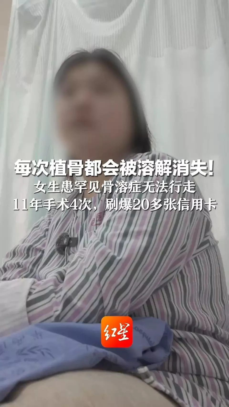 女孩15岁时摔伤手术后大腿骨头“消失”：每次植骨后都会溶解