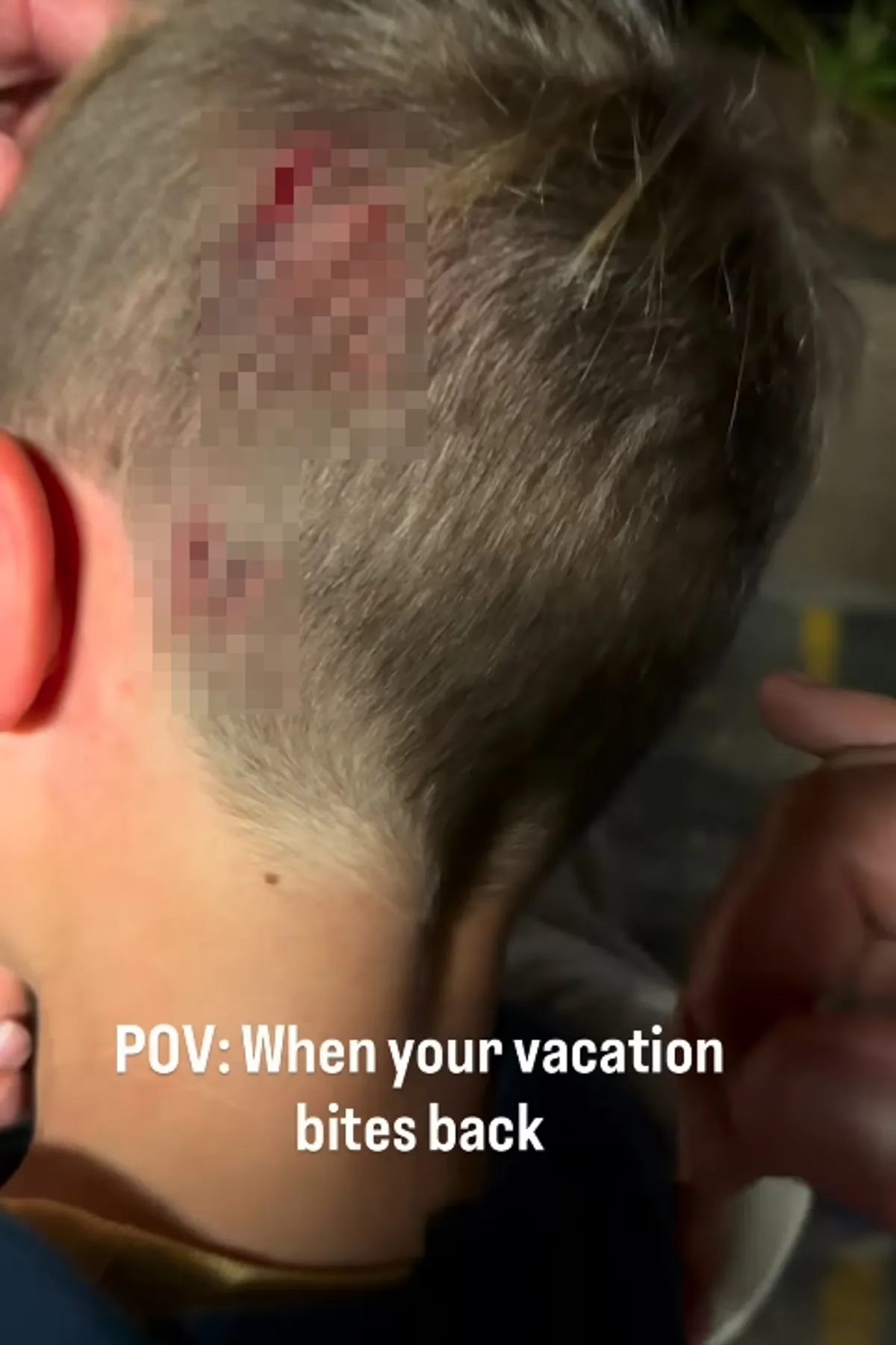 恐怖瞬间!澳洲男童动物园体验 遭蛇咬头爆血 恐怖瞬间!澳洲男童动物园体验 遭蛇咬头爆血