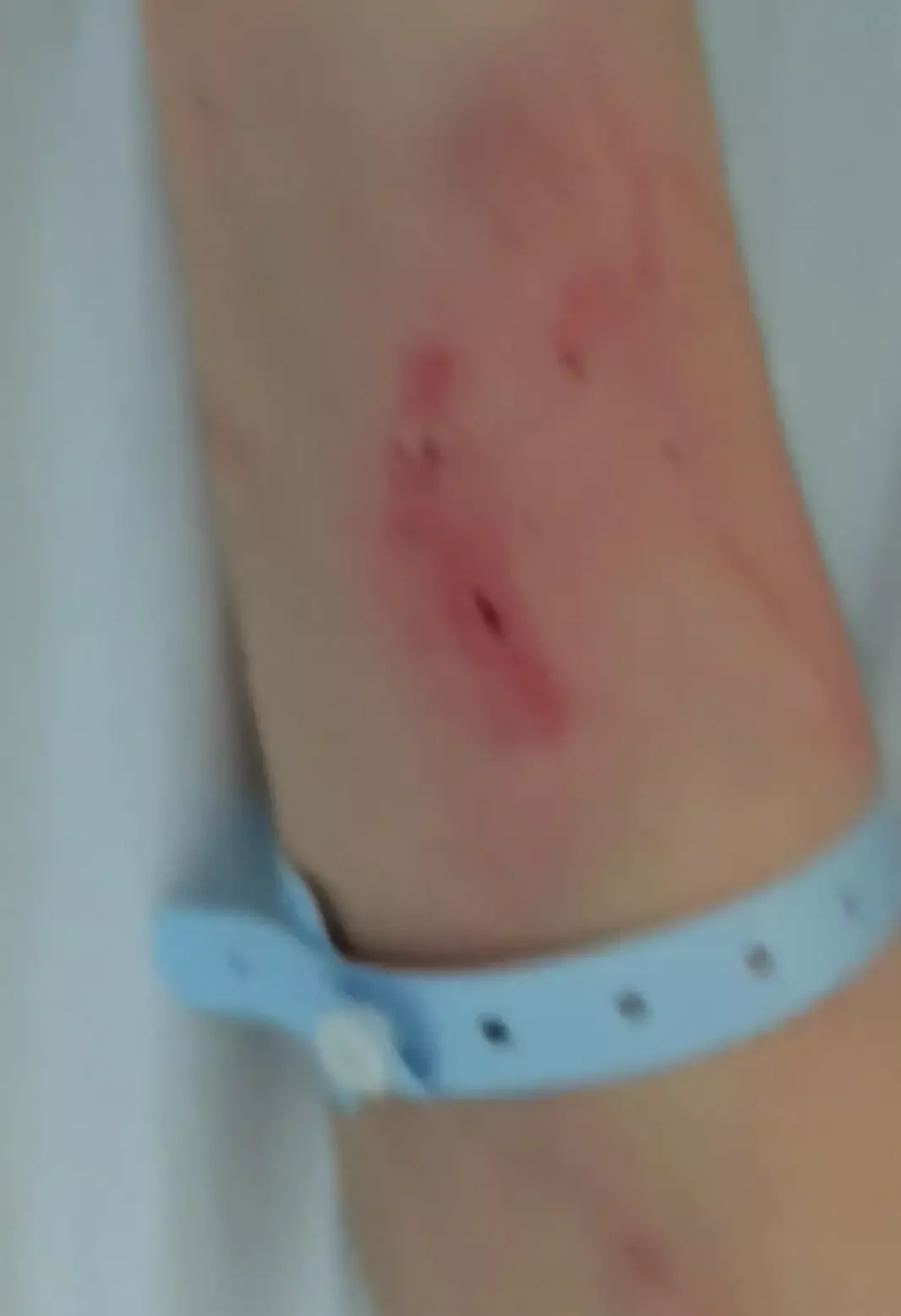 ▲曹某某身上的伤