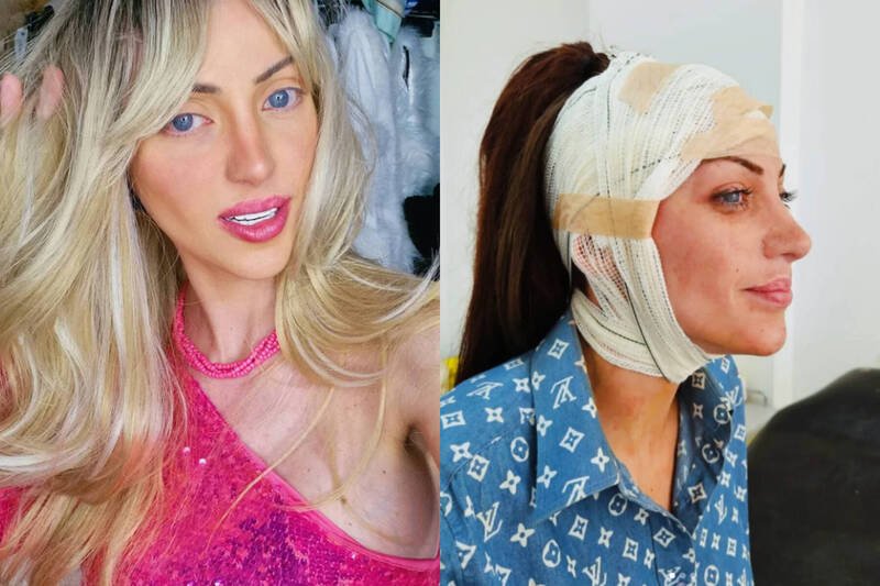 巴西31岁网红芭芭拉接受20多次整形手术，在社群平台小有名气。（本报合成，撷取自Boneca Desumana/IG）