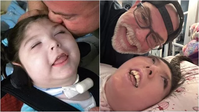 「天生无脑」被医判活不到5岁！她奇迹庆祝20岁生日