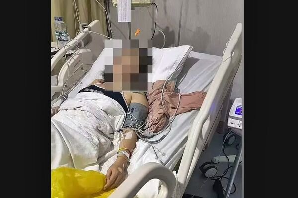 中国正妹巴厘岛半裸死亡 疑似离奇死因被曝