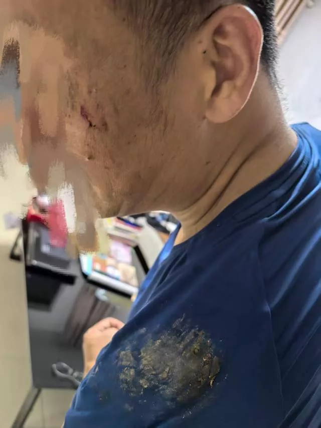 男子曝骑哈啰单车轻捏刹车却刹死,翻进花坛人受伤蔡司镜片被刮花